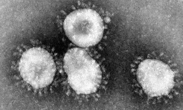 Covid-19 adalah virus beramplop